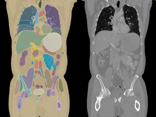Medical AI Training: Open-Source Tools + Advanced Models