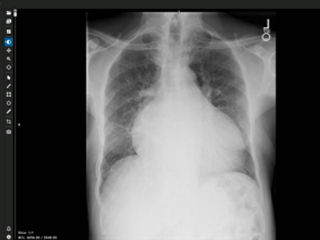 Intelligent Diagnostic Imaging